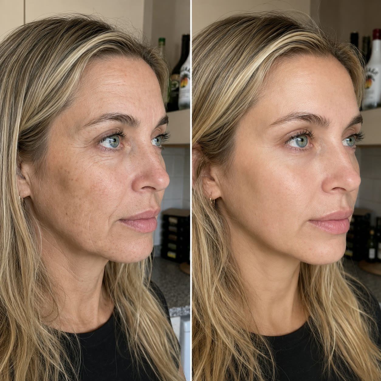 Antes e depois — cliente Coreamy